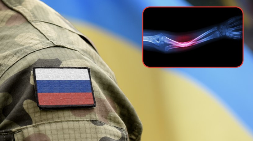 Rosjanie wyszukują w Google "jak złamać rękę w domu" w obawie przed wstąpieniem do wojska /123RF/PICSEL