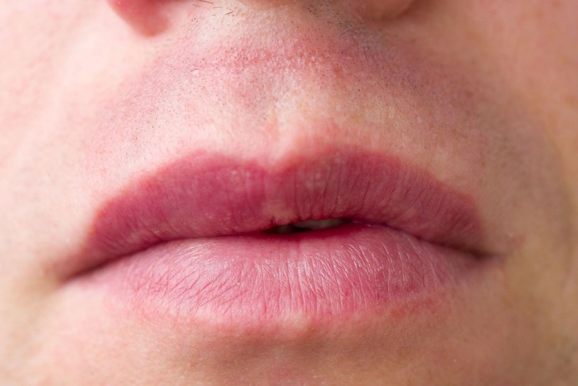 Rozmyty kształt ust może być powodem do niepokoju /123RF/PICSEL