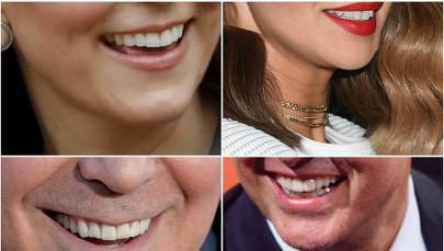 Rozpoznaj gwiazdę po jej uśmiechu!