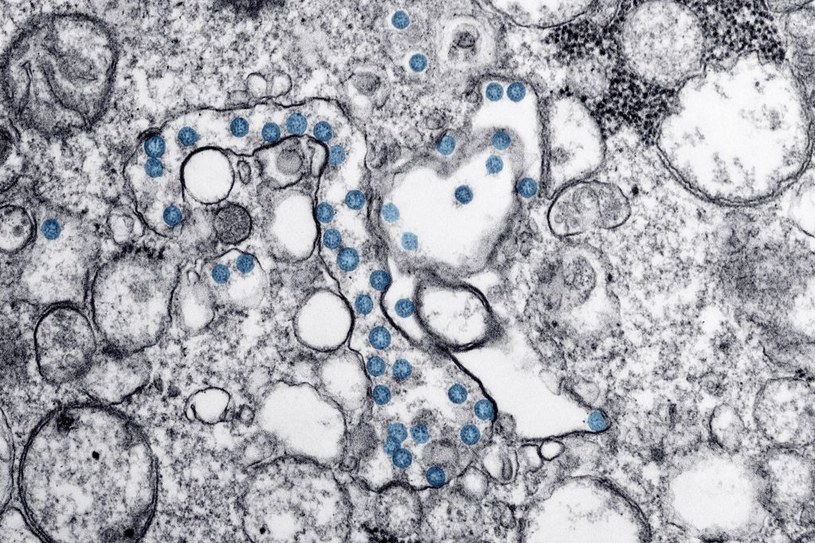 Rozprzestrzenianie się koronawirusa w organizmie, zdjęcie ilustracyjne /Smith Collection/Gado /Getty Images