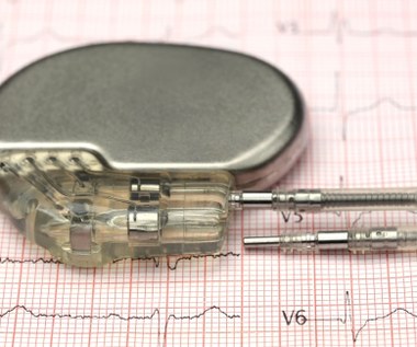 Rozrusznik serca - medyczny cud techniki