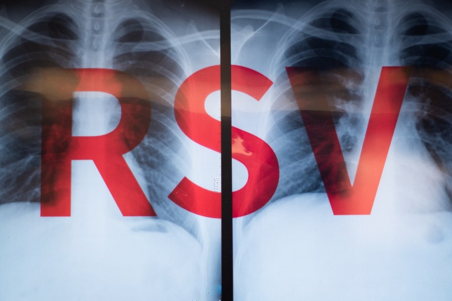 RSV uderza z podwójną siłą! Rekordowa liczba zachorowań w Polsce. Kto jest najbardziej zagrożony i jak się chronić? /Shutterstock