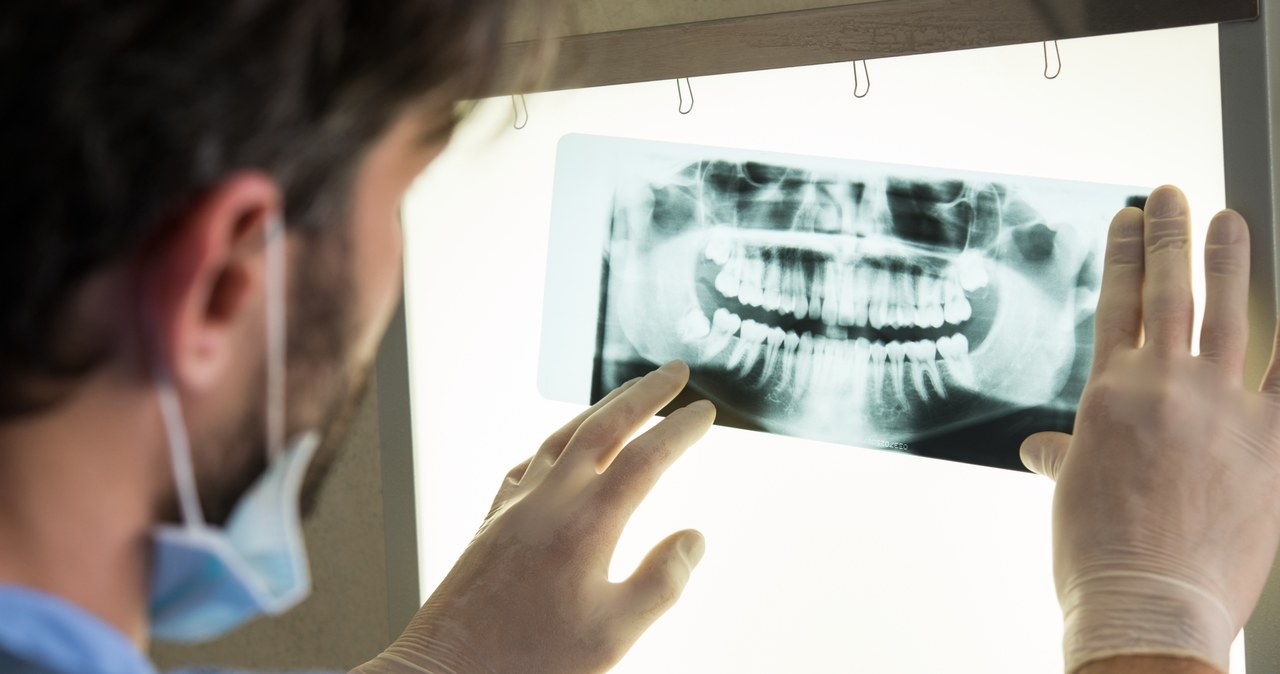 Rtęć, która przez lata była używana przez dentystów w leczeniu pacjentów, trafiła na listę surowców zakazanych w UE /123RF/PICSEL
