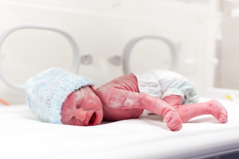 Rumień toksyczny może pojawić się już w drugiej dobie życia noworodka /123RF/PICSEL