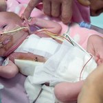 Rzadki przypadek medyczny - dziecko z sercem poza klatką piersiową