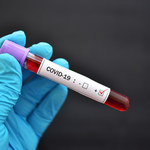 "Rzeczpospolita": Fiskus nie weźmie PIT od testów na koronawirusa