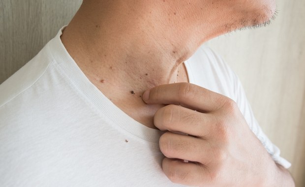 Samobadanie skóry - jak wykonać? [FILM]