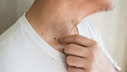 Samobadanie skóry - jak wykonać? [FILM]