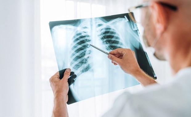 Sanepid zabrał głos ws. gruźlicy u ucznia krakowskiej szkoły