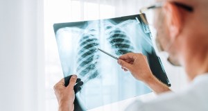 Sanepid zabrał głos ws. gruźlicy u ucznia krakowskiej szkoły