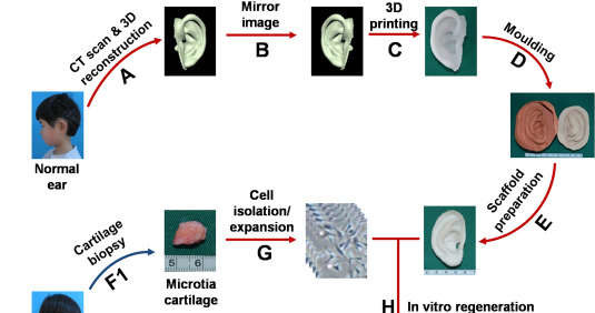 Schemat procedury /fot. EBioMedicine /materiały prasowe