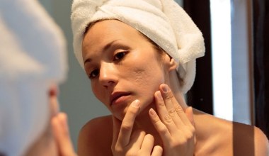 Sekret pięknej skóry tkwi w doborze pielęgnacji do typu cery. Czym się kierować wybierając kosmetyki?