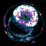 Sensacja naukowa: Kopia ludzkiego embrionu stworzona bez jajeczka i spermy