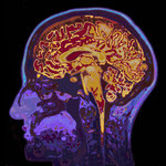 Sensacyjne odkrycie - mózg może produkować fruktozę?