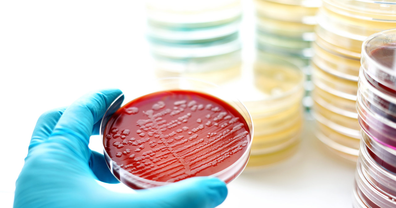 Sepsa rozwija się na skutek kontaktu z bakteriami, wirusami lub grzybami. /123RF/PICSEL