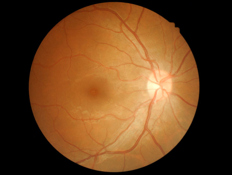 Siatkówka i nerw wzrokowy /123RF/PICSEL