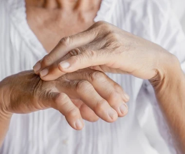 Siniejące palce lub dłonie to objaw. Tak daje o sobie znać krążenie, ale nie tylko