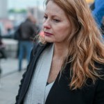 Skibińska przeszła nieudaną operację plastyczną: "Ciało zaczęło odrzucać materiał"