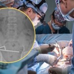 Skończyło się operacją. Nie uwierzysz, co nastolatek miał w jelicie