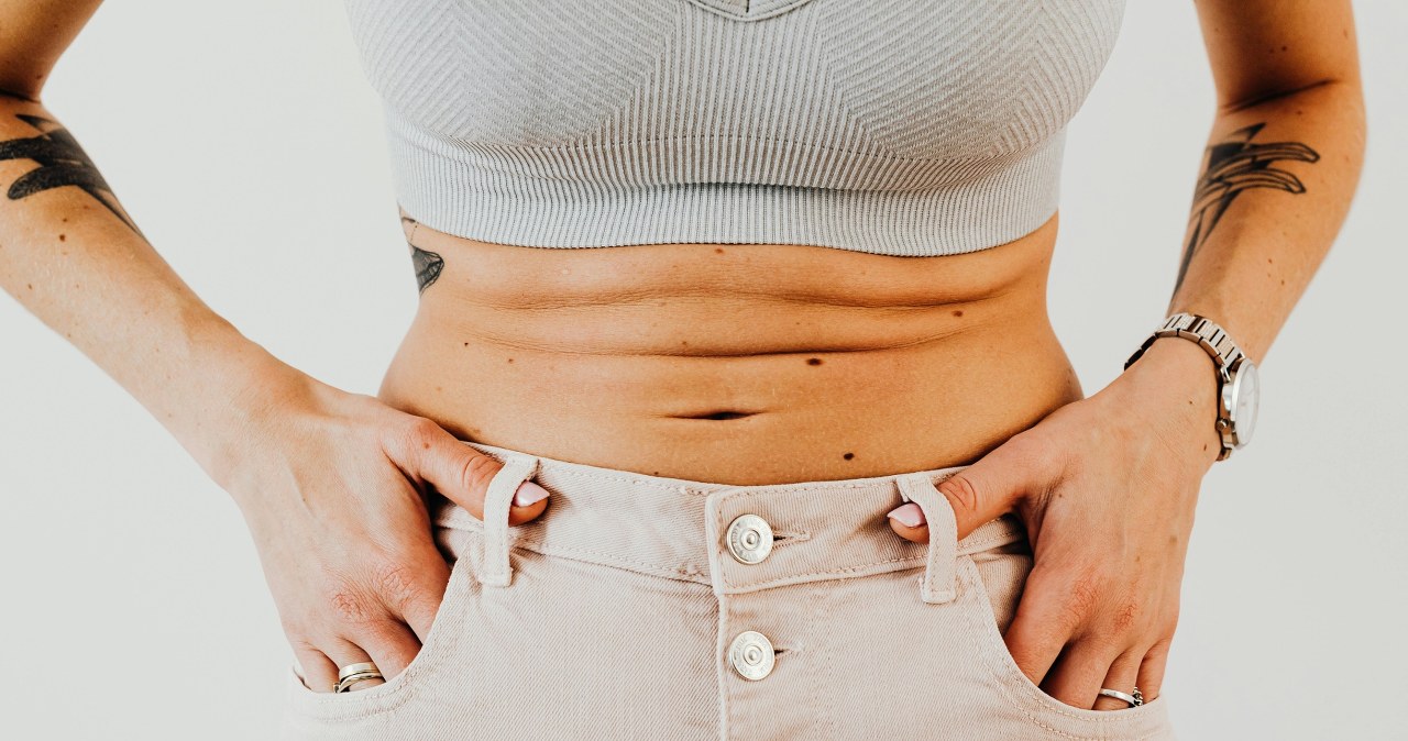 Skóra brzucha po odchudzaniu, która potrzebuje zabiegu ujędrniającego /Karola G /pexels.com