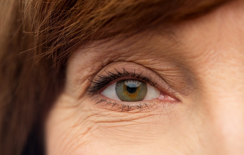 Skóra wokół oczu jest szczególnie narażona na powstawanie zmarszczek. Tam też pojawiają się najwcześniej /123RF/PICSEL