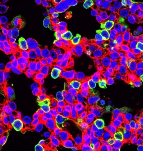 Skorygowane metodą CRISPR komórki (zielone), zawierają fluorescencyjne białko EGFP. Wiele z nich, ale nie wszystkie, to komórki nabłonkowe pęcherzyków /Ed Morrisey, Penn Medicine /Materiały prasowe
