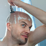 Skuteczne sposoby na męskie łysienie