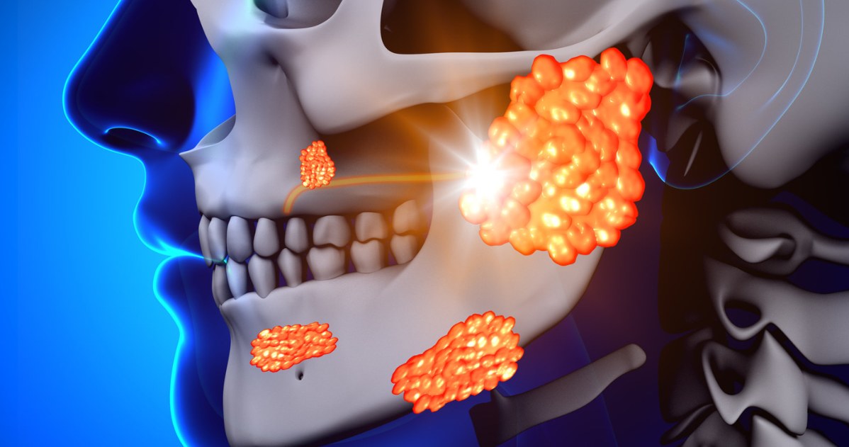 Ślinianki znajdują się w okolicy policzków i odpowiadają za produkcję śliny /123RF/PICSEL
