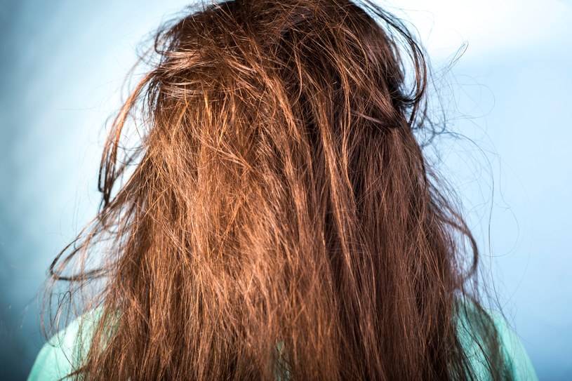 Słońce szkodzi włosom. Jak je chronić? Podpowiadamy /123RF/PICSEL