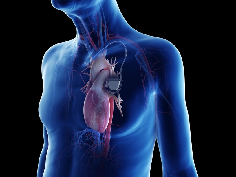 Smartwatche mogą zakłócić działanie rozruszników serca /123RF/PICSEL