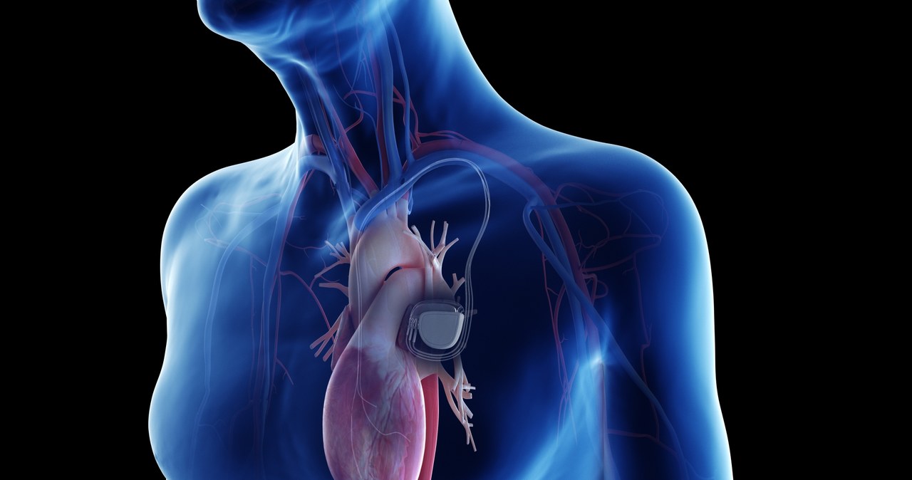 Smartwatche mogą zakłócić działanie rozruszników serca /123RF/PICSEL