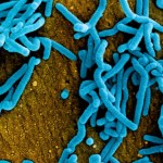 Wirus gorączki krwotocznej Marburg.