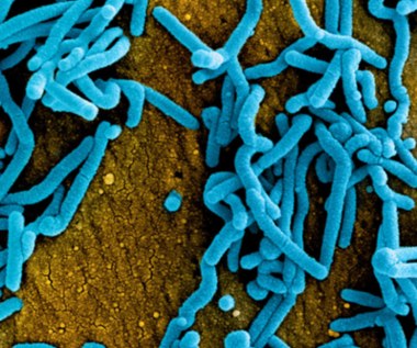Śmiertelnie groźny wirus Marburg wykryty w Afryce. Jest spokrewniony z ebolą