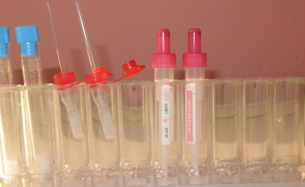 Śmiertelnie groźny wirus przewozili w opakowaniu po kosmetykach. Nowe ustalenia