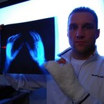 Soszyński złamał rękę przez używane rękawice