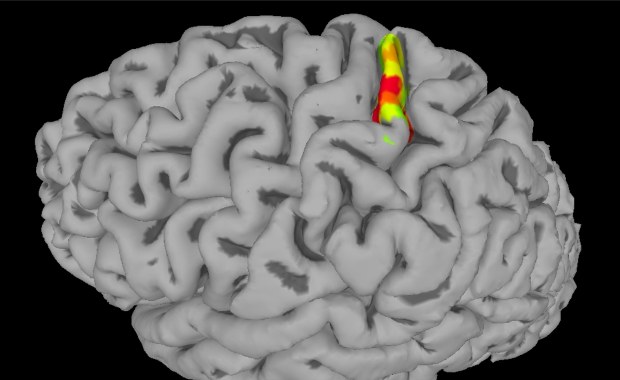Spory sukces naukowców. Przywrócili sparaliżowanemu dotyk