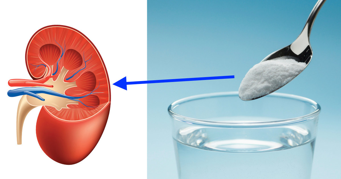 Sposób na kamienie nerkowe /© Photogenica