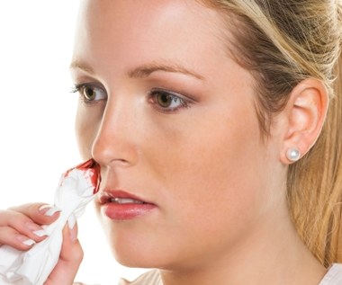 Sposoby na krwotok z nosa