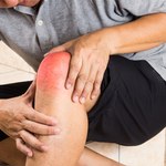 Sprawdzone sposoby na opuchnięte kolana