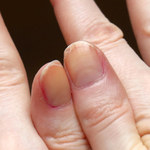 Sprawdzone sposoby na rozdwajające się paznokcie