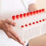 Stan zapalny może się "ukrywać". Trzy badania, które wykryją zapalenie w organizmie 