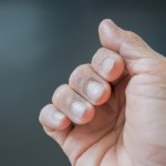 Stan zdrowia zapisany na paznokciach? To sygnały, które lepiej skonsultować z lekarzem