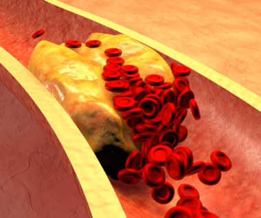 Statyny. Leki nie tylko na cholesterol 