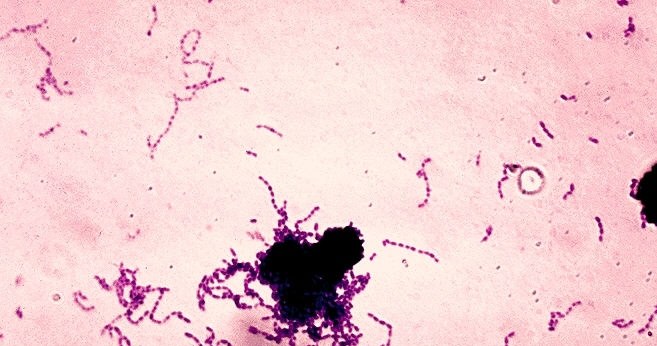 Streptococcus mutans i inne bakterie są głównym powodem powstawania próchnicy zębów. Naukowcy wskazują jednak, że duży wpływ mają także drożdżaki / Centers for Disease Control and Prevention's Public Health Image Library /Wikimedia