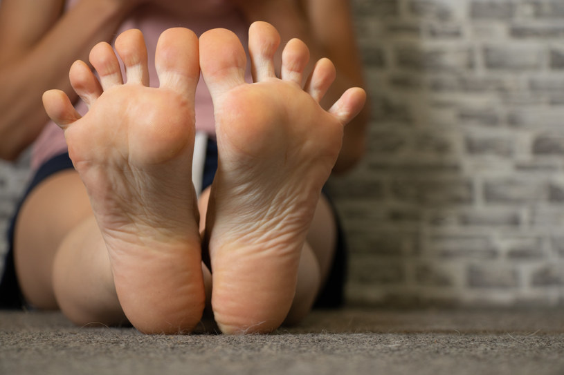 Sucha skóra stóp oraz popękane pięty mogą świadczyć o niedoczynności tarczycy /123RF/PICSEL
