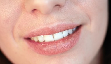 Suche i popękane usta. Problem występuje nie tylko jesienią i zimą