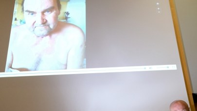 Sukces polskich chirurgów. Przeszczepili 65-latkowi narządy szyi, potem szpik