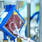 Sukces warszawskich lekarzy. Rekordowe ECMO i przeszczep uratowały 18-latka