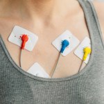 "Superludzka" AI wykrywa chore serce w kilka sekund. Wystarczy EKG