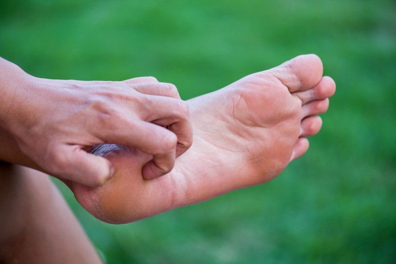 Świąt stóp oraz dłoni mogą świadczyć o problemach z wątrobą /123RF/PICSEL
